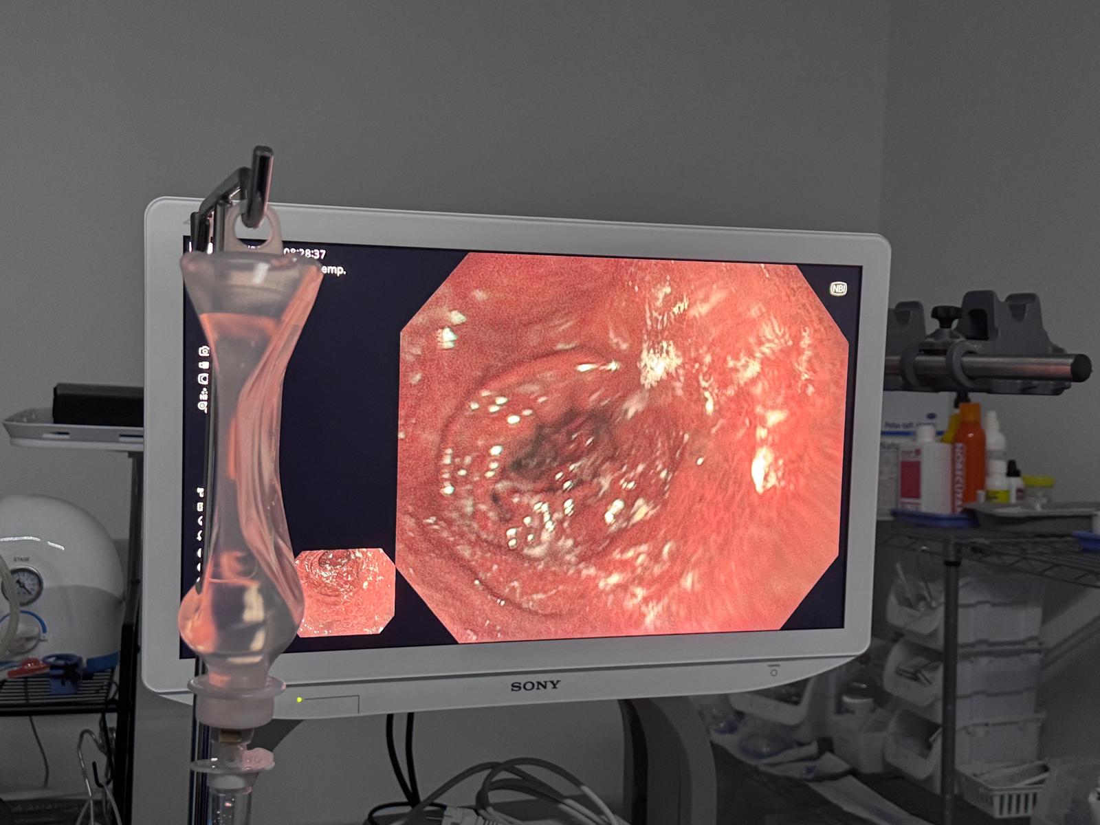 traumatología valdepeñas